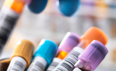 Colored blood collection tubes in laboratory setting, representing clinical sample collection and laboratory testing in clinical research